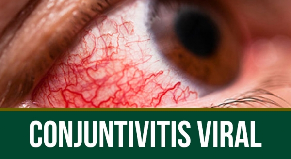 Conjuntivitis viral